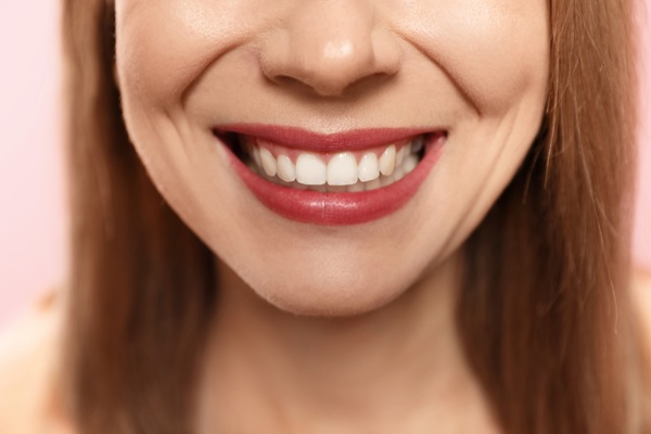 Why Choose Implant Supported Dentures? Top Benefits Explained